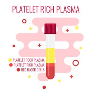 Platelet rich plasma