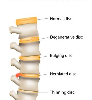 treating spine and neck pain